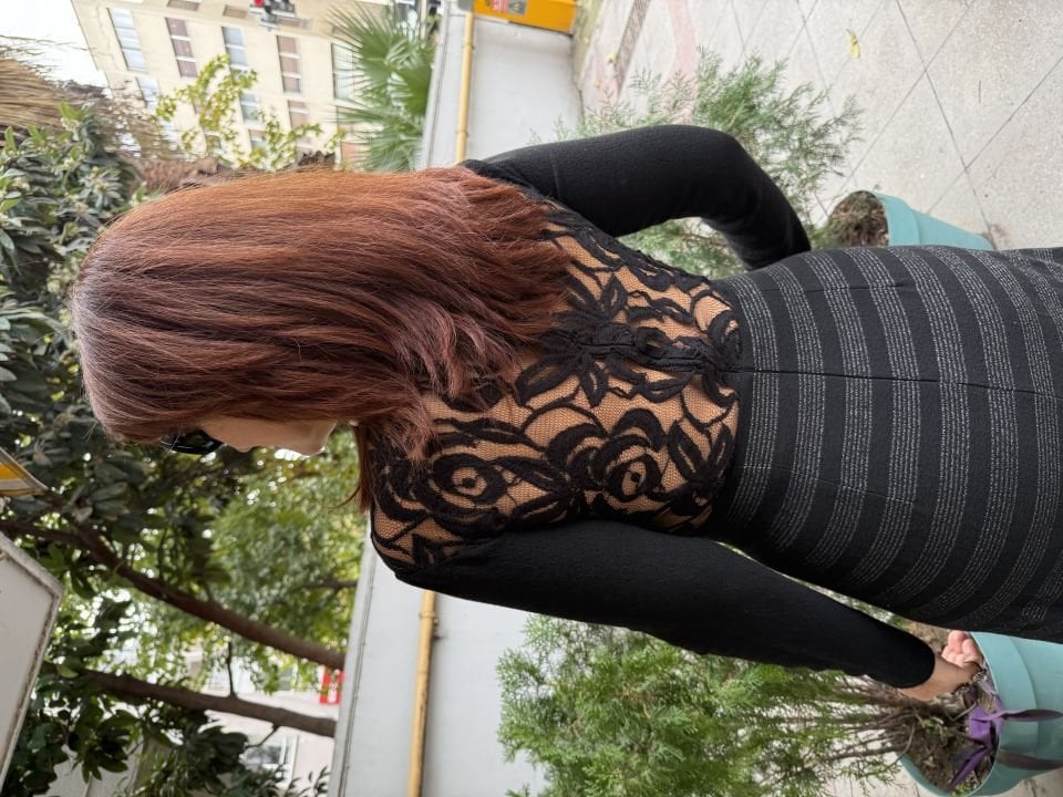 Sırt Detaylı Çizgili Elbise